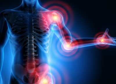 w27vaelipyqt-musculoskeletal-disorders